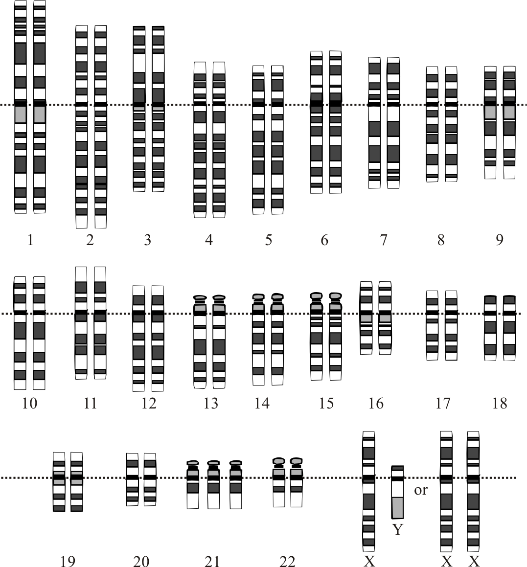 Genetic Origins Of Down Syndrome Wikidoc