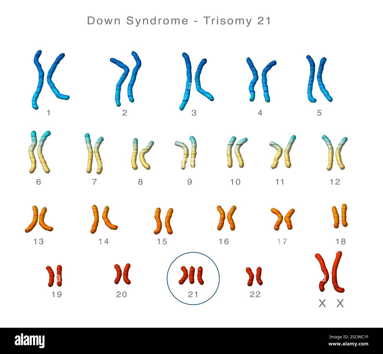 Trisomy Of Chromosome 21 Stock Vector Illustration Of Number 159581013
