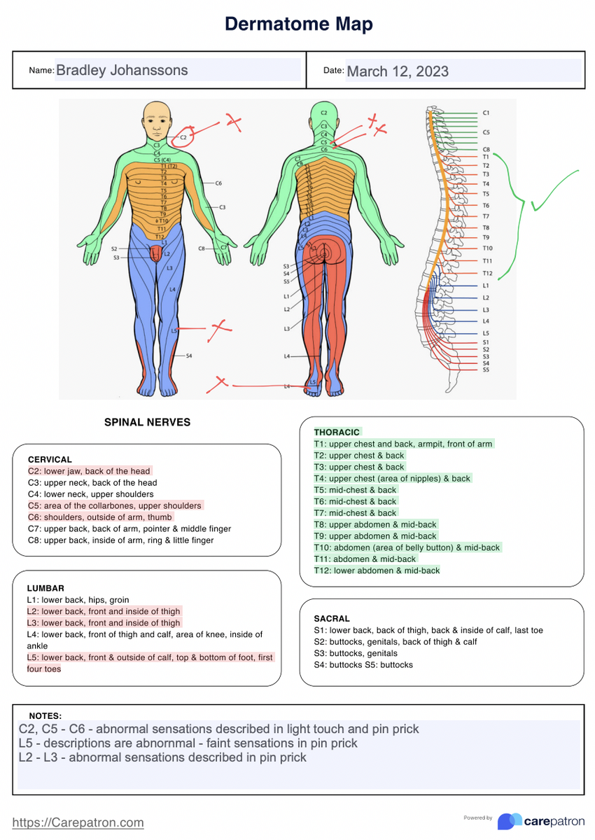 Dermatomes Cutaneous Nerves Chart A4 JPG Printable Anatomy Poster For Medical Study And Teaching Etsy