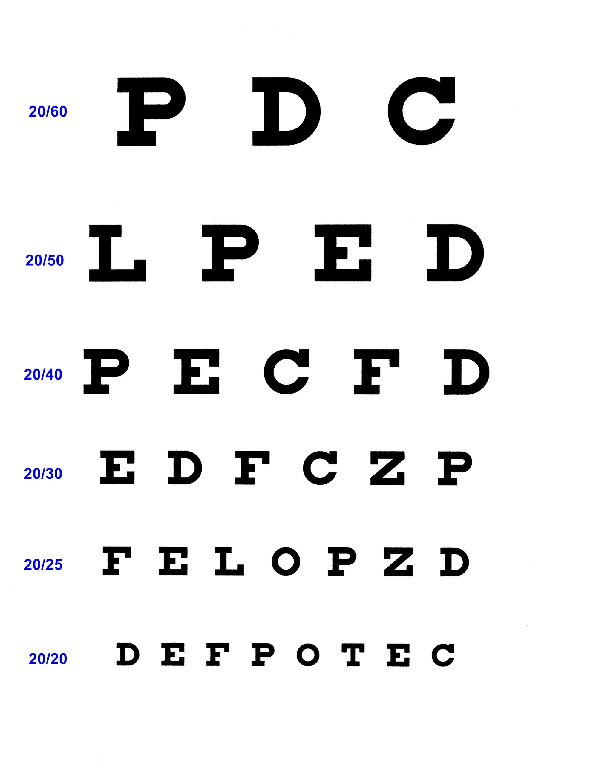 Opthalmoscope Otoscope Set Snellen Eye Chart Visual Acuity Chart 22x11 Inches For Eye E Tuning Fork